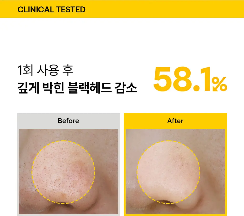 [5년연속1위/블랙헤드OUT] 마녀공장 퓨어 클렌징 오일 300ml 기획 (+25mlx2) 상세페이지 17